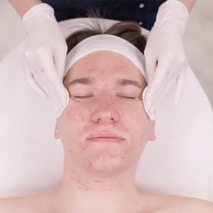 Advanced therapy - Exozomálne ošetrenie citlivej, žilkovatej pleti a pleti s rosacea Advanced therapy - Exozomálne ošetrenie citlivej, žilkovatej pleti a pleti s rosacea