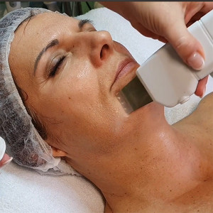 Hydroabrazívne čistenie pleti Hydroabrazívne čistenie pleti