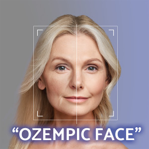 Volumetrick korekcia tvrovej architektry  nvrat mladistvch kontr bez skalpela