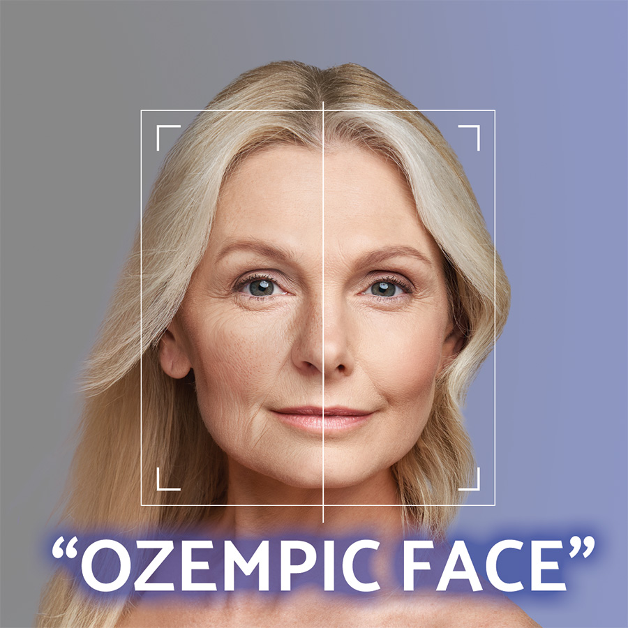 Volumetrick korekcia tvrovej architektry  nvrat mladistvch kontr bez skalpela